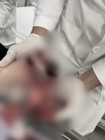 Tai nạn lao động ở Công ty Tôm