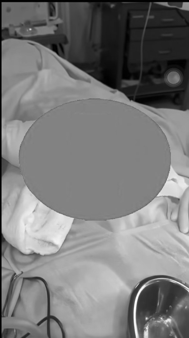 VI:DEO 0CHE: Toàn cảnh sự việc